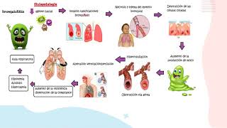 Bronquiolitis parte 1FisiopatologíaPediatría [upl. by Cini]