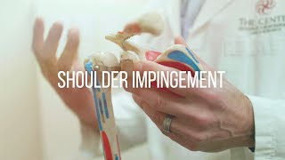 Shoulder Impingement Causes and Treatment [upl. by Mercer]