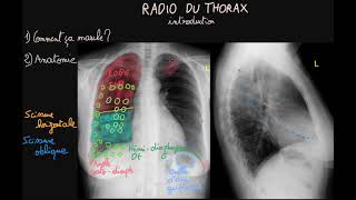 Radio du thorax  Introduction  Partie 1  Docteur Synapse [upl. by Kizzie]