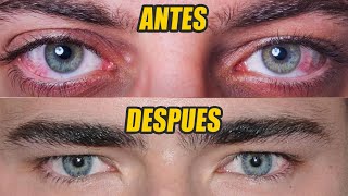 Cómo Tener Ojos Atractivos Y Bonitos Hombres  5 Maneras Fáciles [upl. by Anestassia589]