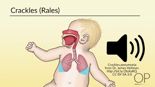 Respiratory Assessment by B Leary L DelSignore  OPENPediatrics [upl. by Cowden213]