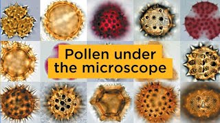 Pollen under the microscope [upl. by Almallah874]