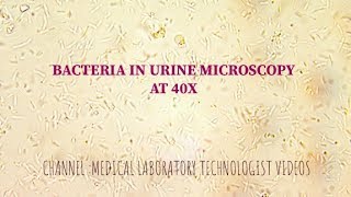 Frequent UTIs for Guys  Fairbanks Urology [upl. by Westland]