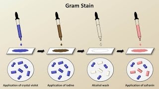 How to GET RID of Bladder Infections  Recurrent UTI [upl. by Airotel846]