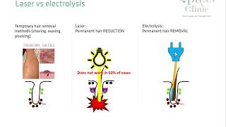 Laser hair removal vs Electrolysis [upl. by Hanus274]