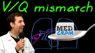 Ventilation Perfusion VQ Mismatch Explained Clearly [upl. by Freya]