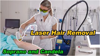 Laser Hair Removal  using Soprano Ice Platinum Laser amp Candela Laser Best Hair Removal in 2021 [upl. by Akinahs]