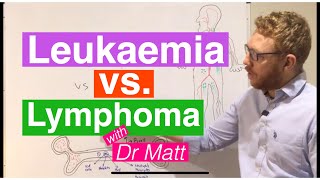 Follicular Lymphoma Everything You Need to Know [upl. by Eissolf120]