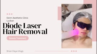 Diode Hair Laser Removal [upl. by Arikal]