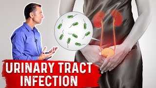 Urinary Tract Infection UTI Symptoms Causes amp Risk Factors [upl. by Constanta499]