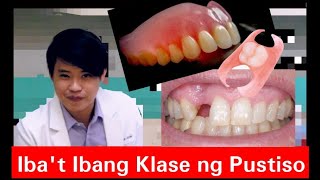 Ibat Ibang Klase ng PUSTISO Metal Flexible Stayplate Complete Denture 20 [upl. by Dachy]