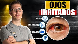 8 REMEDIOS NATURALES PARA LOS OJOS IRRITADOS [upl. by Kermy96]