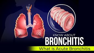 Bronchitis  Acute Bronchitis [upl. by Joris]