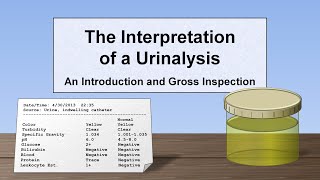 Interpretation of the Urinalysis Part 1  Introduction and Inspection [upl. by Atteuqahc]