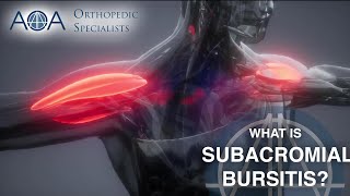 AOA Orthopedic Specialists  Subacromial Bursitis [upl. by Zantos]